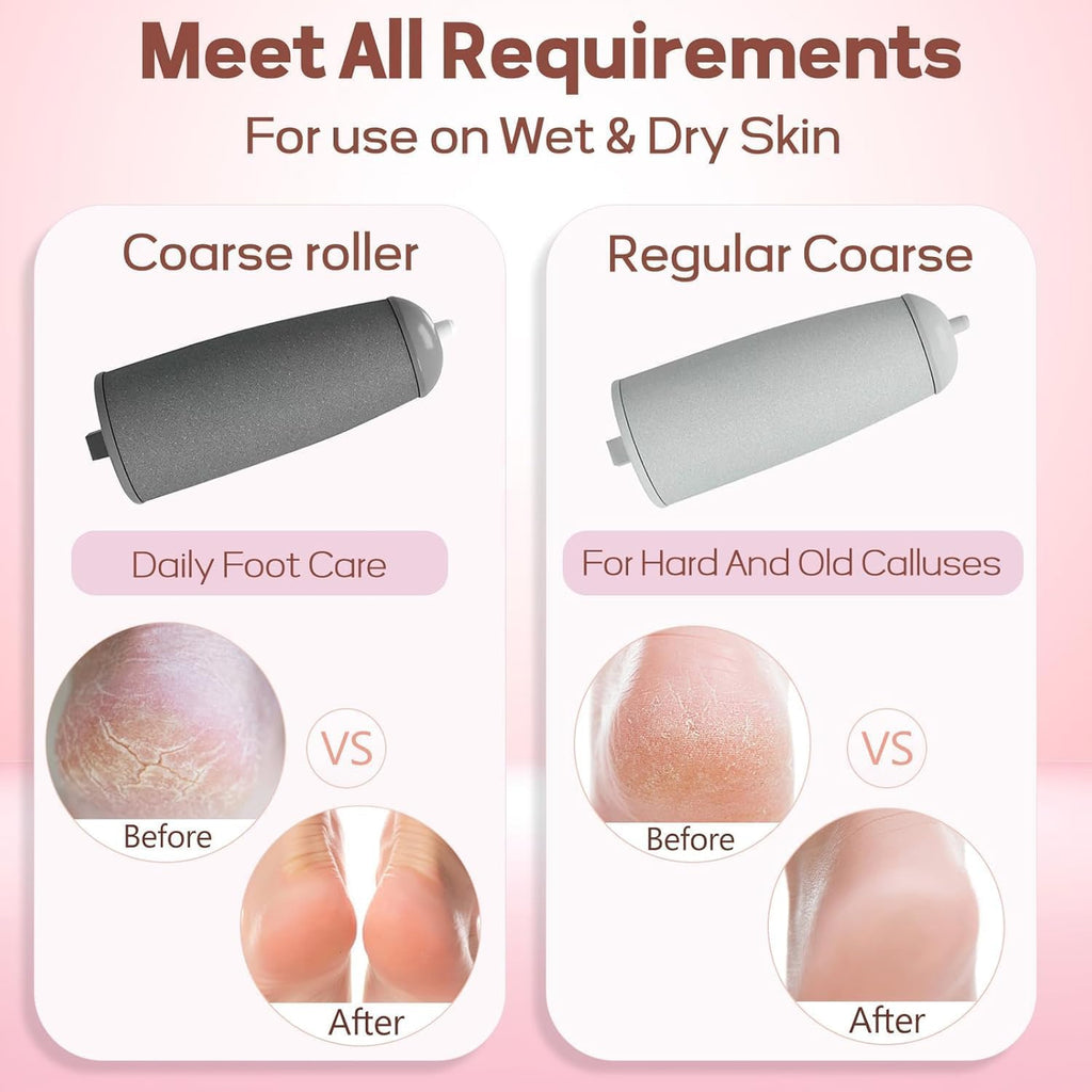 SmoothStep Electric Foot Care Tool™