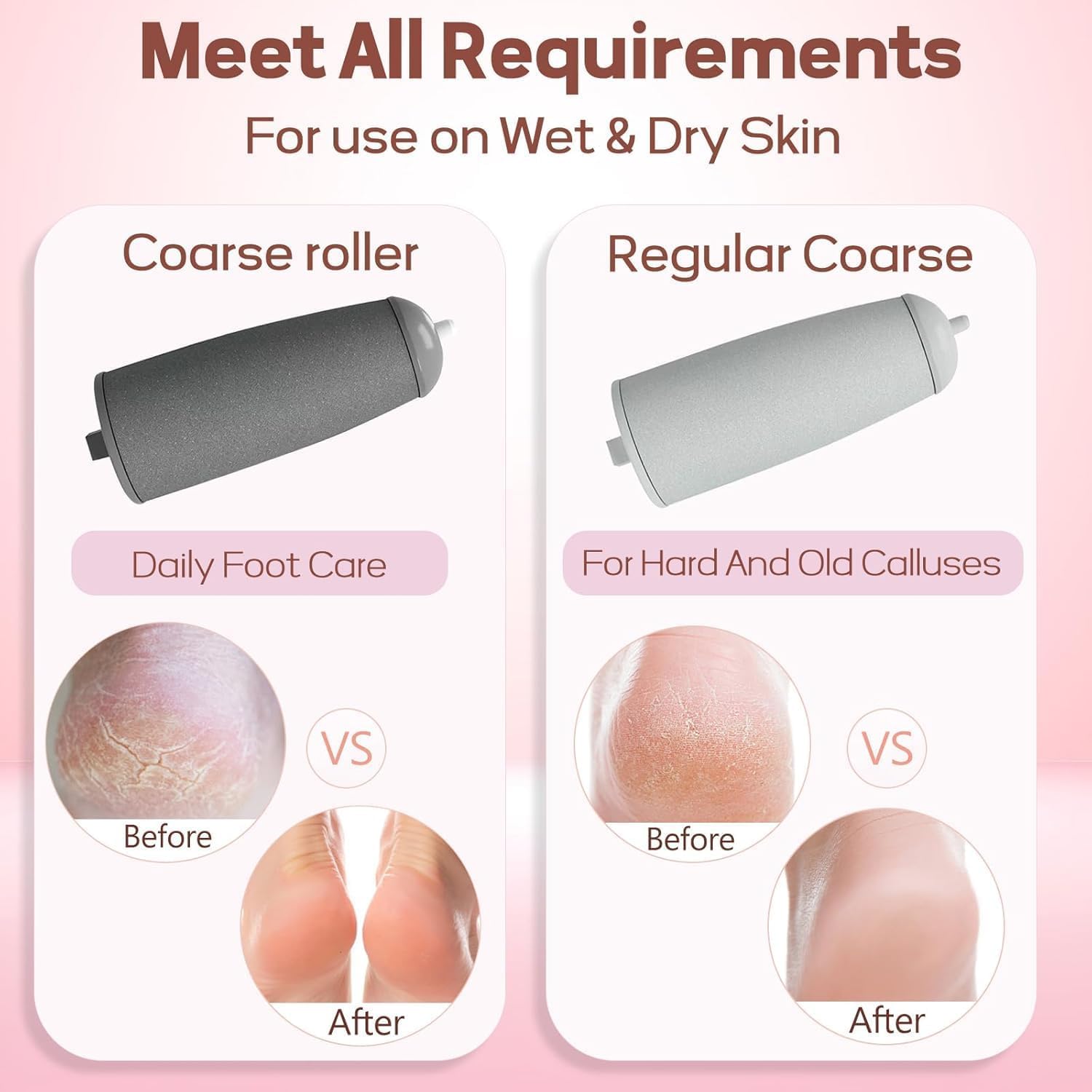 SmoothStep Electric Foot Care Tool™